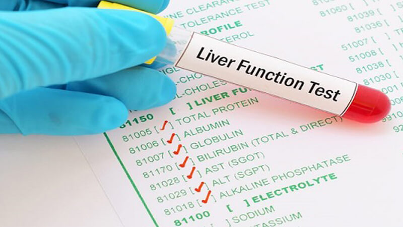 8 ساعات صيام قبل إجراء تحليل وظائف الكلية والكبد